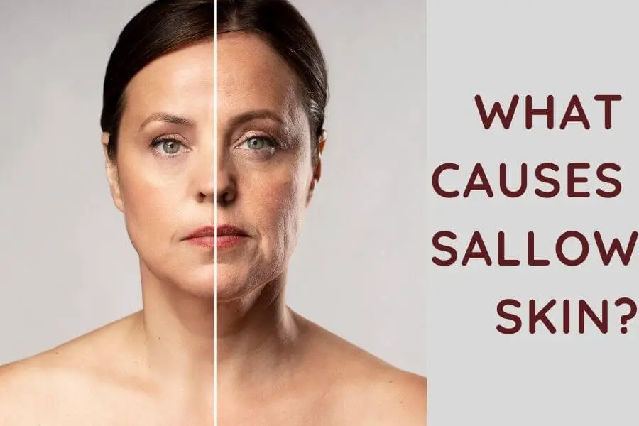 What Causes Sallow Skin?